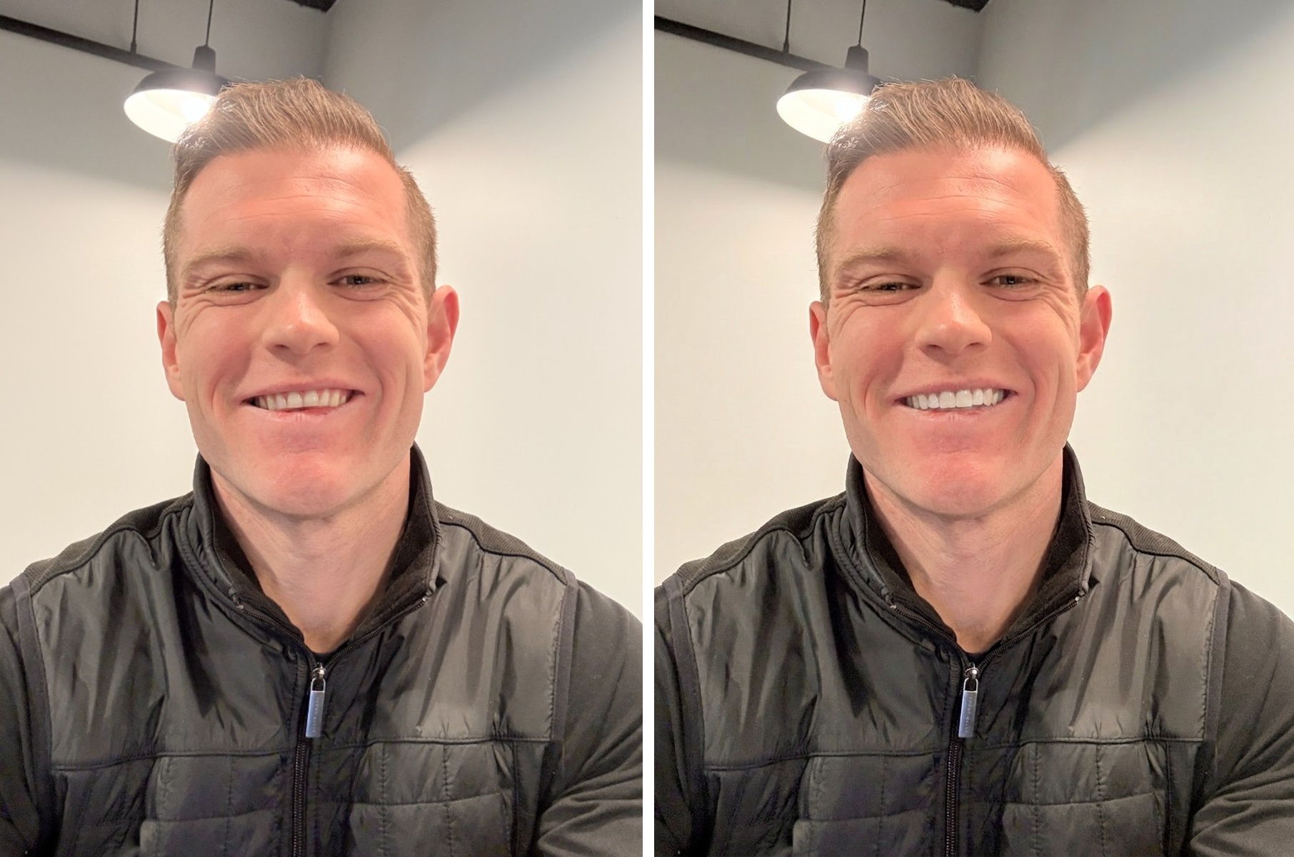 A man indoors before and after with a natural cleaner smile