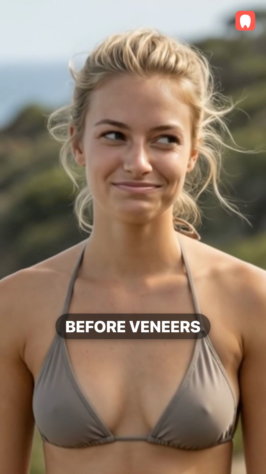 A real Veneerly smile result shared on TikTok