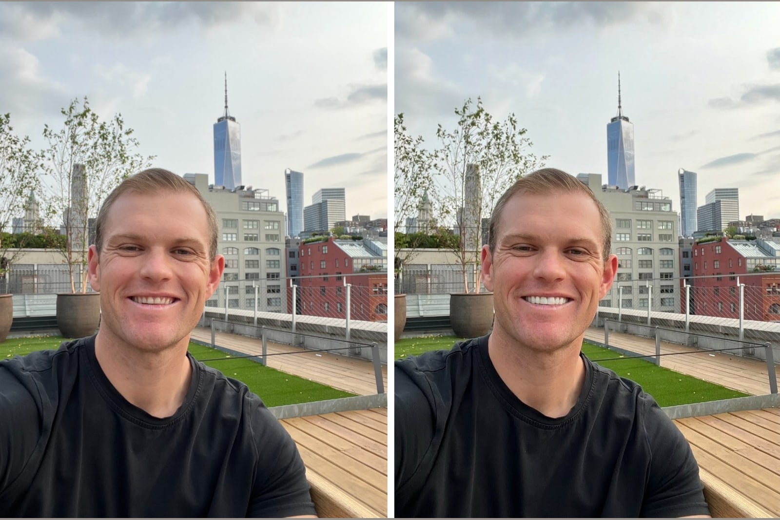 A real smile shown before and after veneers for are veneers worth it