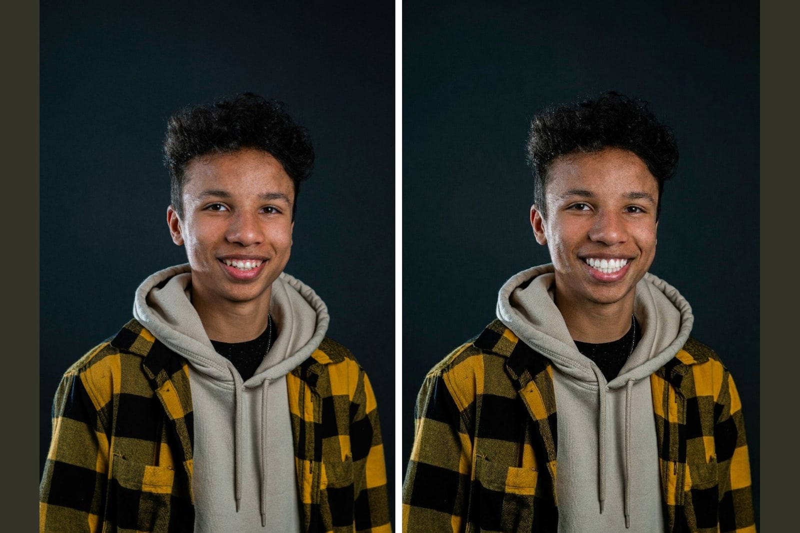A real smile shown before and after veneers, illustrating how much do veneers cost