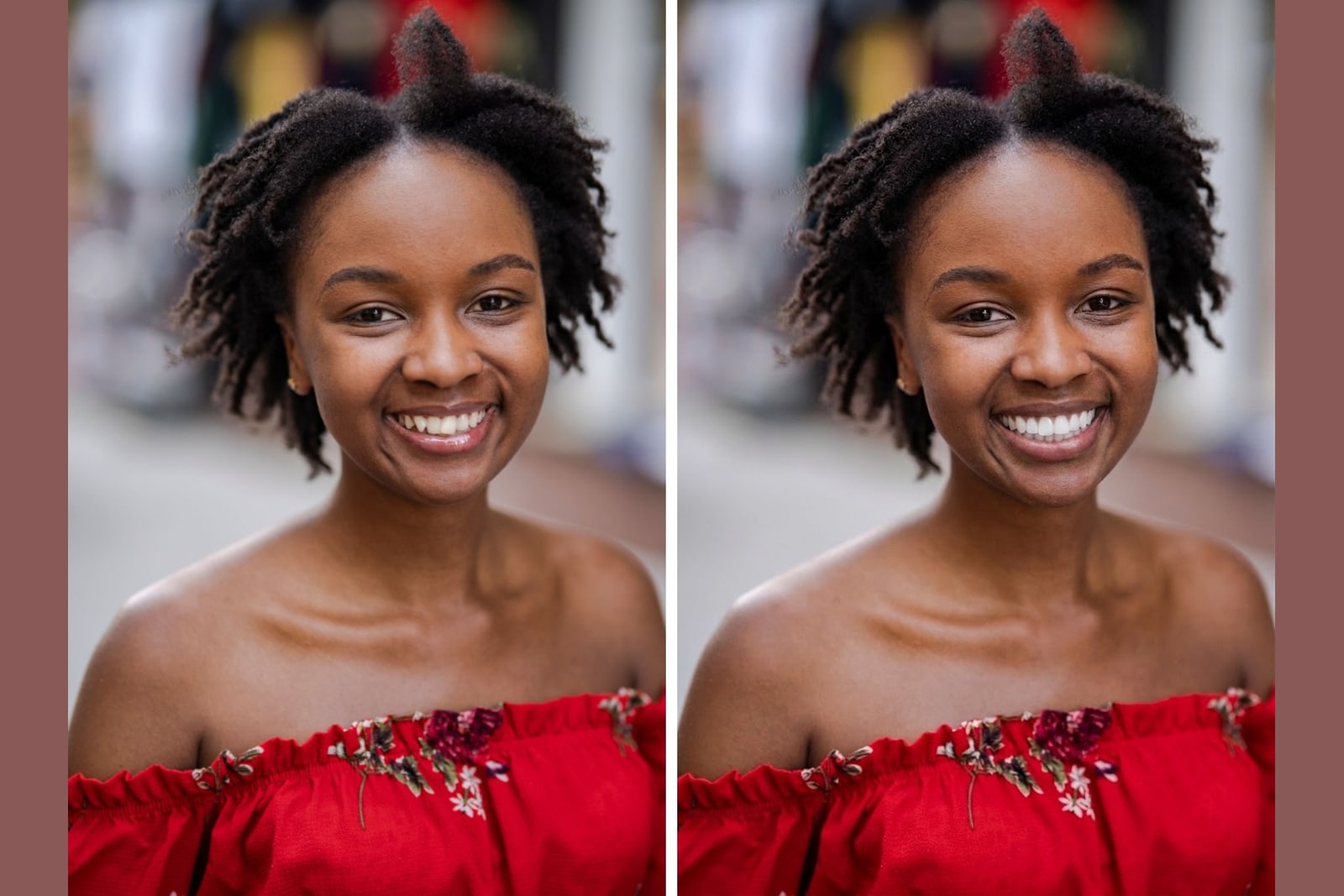 A real smile shown before and after veneers for porcelain veneers