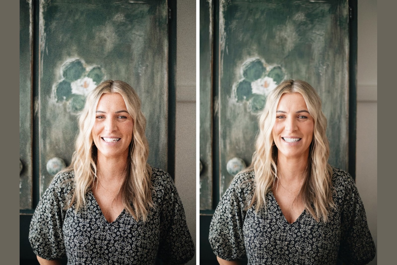 A real smile shown before and after veneers for veneers vs whitening